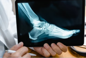 Foot Doctor in Houston Can Handle Both Common Foot Problems and More Complex Surgical Conditions